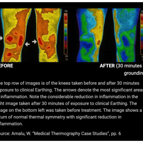 Bareearth Grounding Mat (Official Retailer) [year]