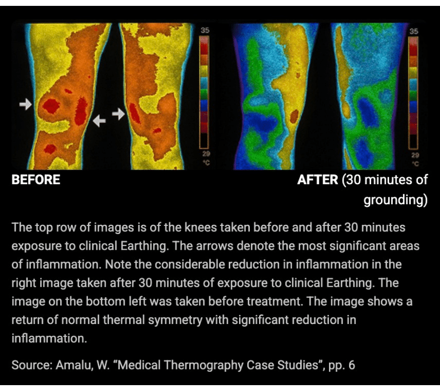 Bareearth Grounding Mat (Official Retailer) [year]